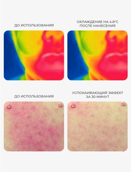 Восстанавливающий крем-гель для чувствительной кожи с 5% пантенола AROCELL  Hyal B5 Soothin Cream80мл